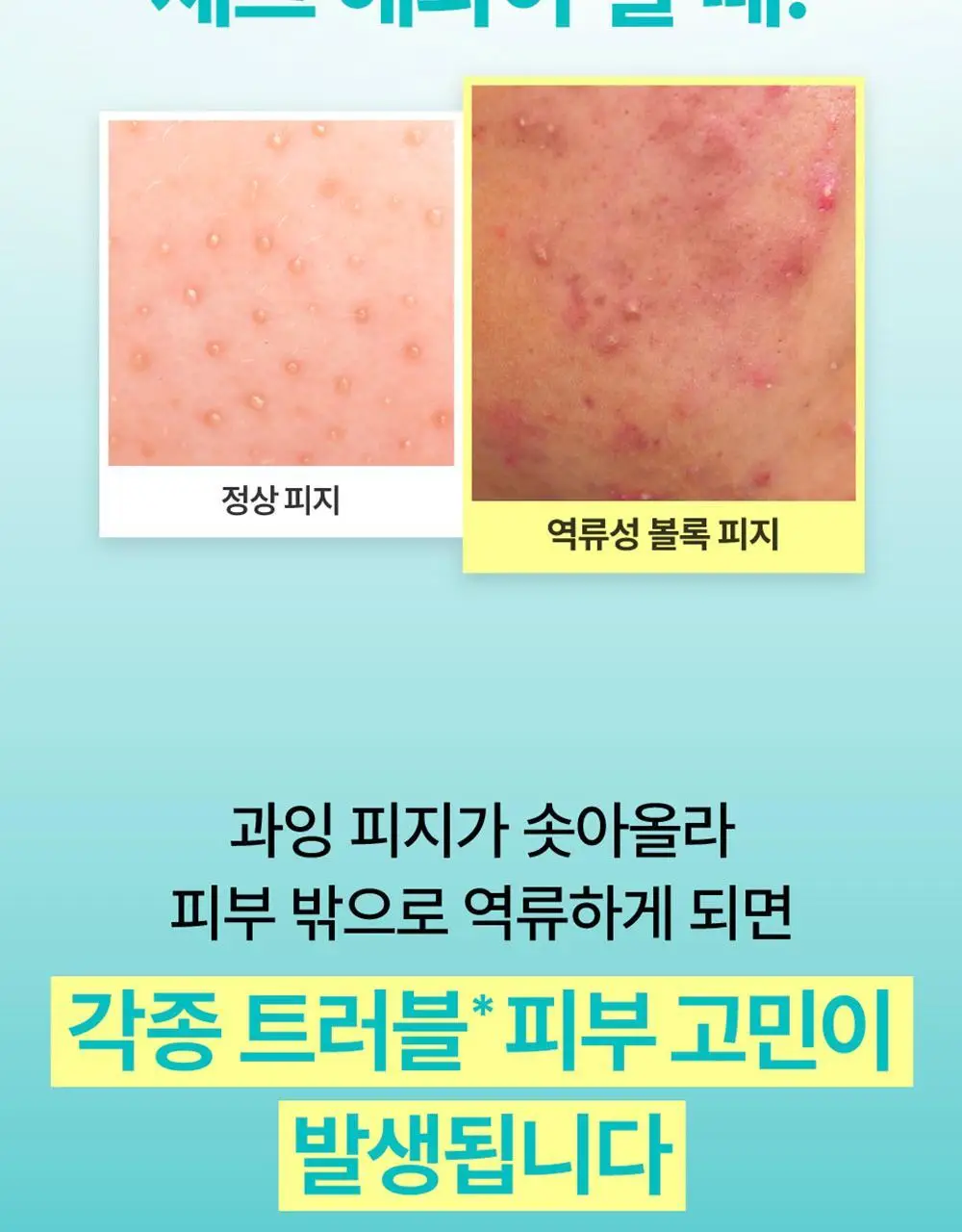 [쿨링진정]넘버즈인 1번 진정 맑게담은 청초토너 300ml 리필기획(+300ml 증정) 상세페이지 11